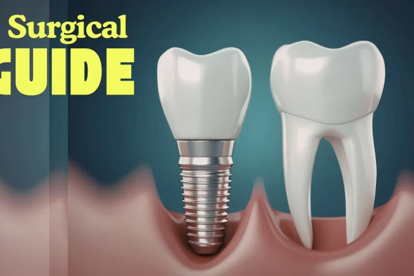 Surgical guide planning